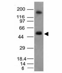 CA9 / Carbonic Anhydrase IX Antibody (clone CA9/781)