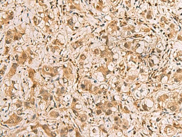 PDXK / PNK Antibody