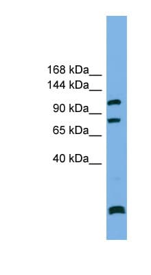 PPP6R1 / SAPS1 Antibody (N-Terminus)