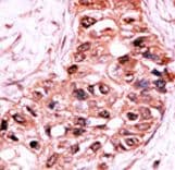 CASP9 / Caspase 9 Antibody (phospho-Ser196)