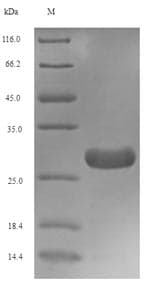 Xenopus laevis TGFB1 / TGF Beta 1 Protein (Recombinant 6His-SUMO, N-terminus)