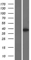MBNL3 Protein (Over-Expression Lysate Myc-DDK (Flag))