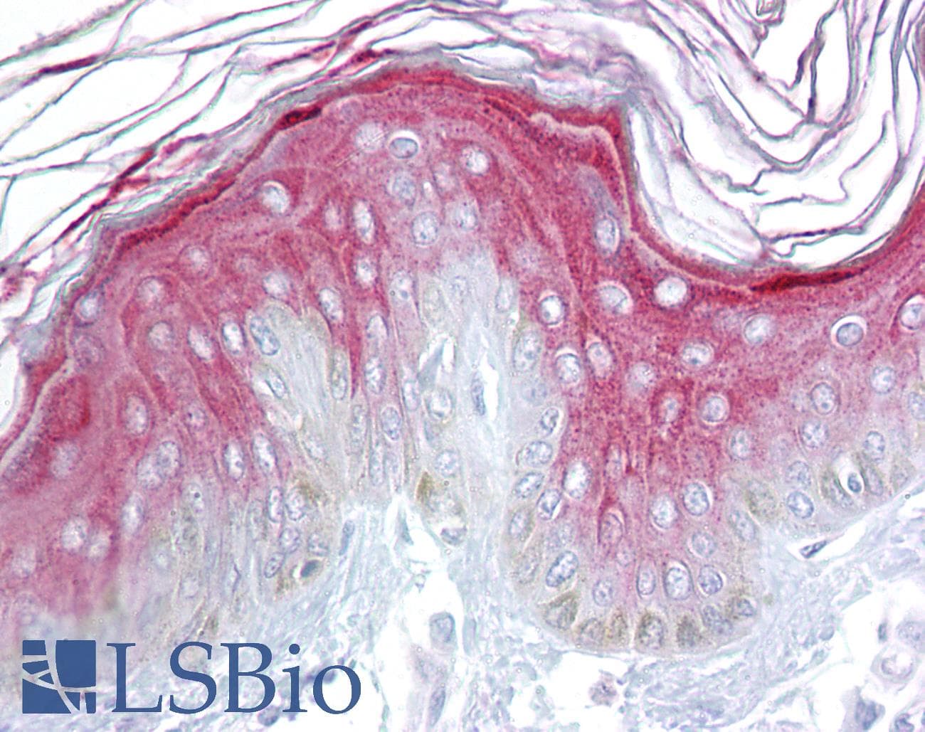 IHC-plus™ AXIN1 / Axin-1 Antibody