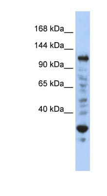 Polyclonal Rabbit anti-Human NFX1 Antibody (N-Terminus, WB)