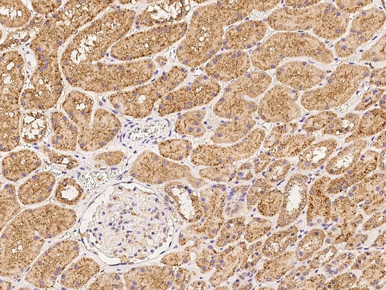 Polyclonal Rabbit anti-Human MRM1 Antibody (IHC)