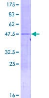 Human RPL18A Protein (Recombinant GST)