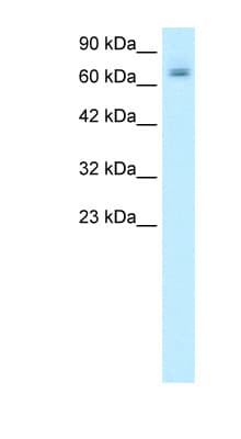 PARP2 Antibody (aa401-450)