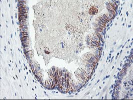 DTNB / Dystrobrevin Beta Antibody (clone OTI3A12)