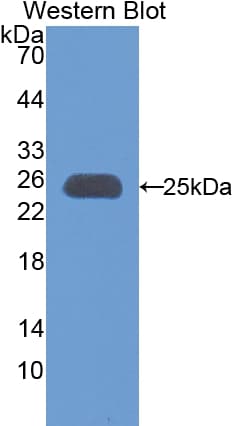 APOM / Apolipoprotein M Antibody (aa20-190)