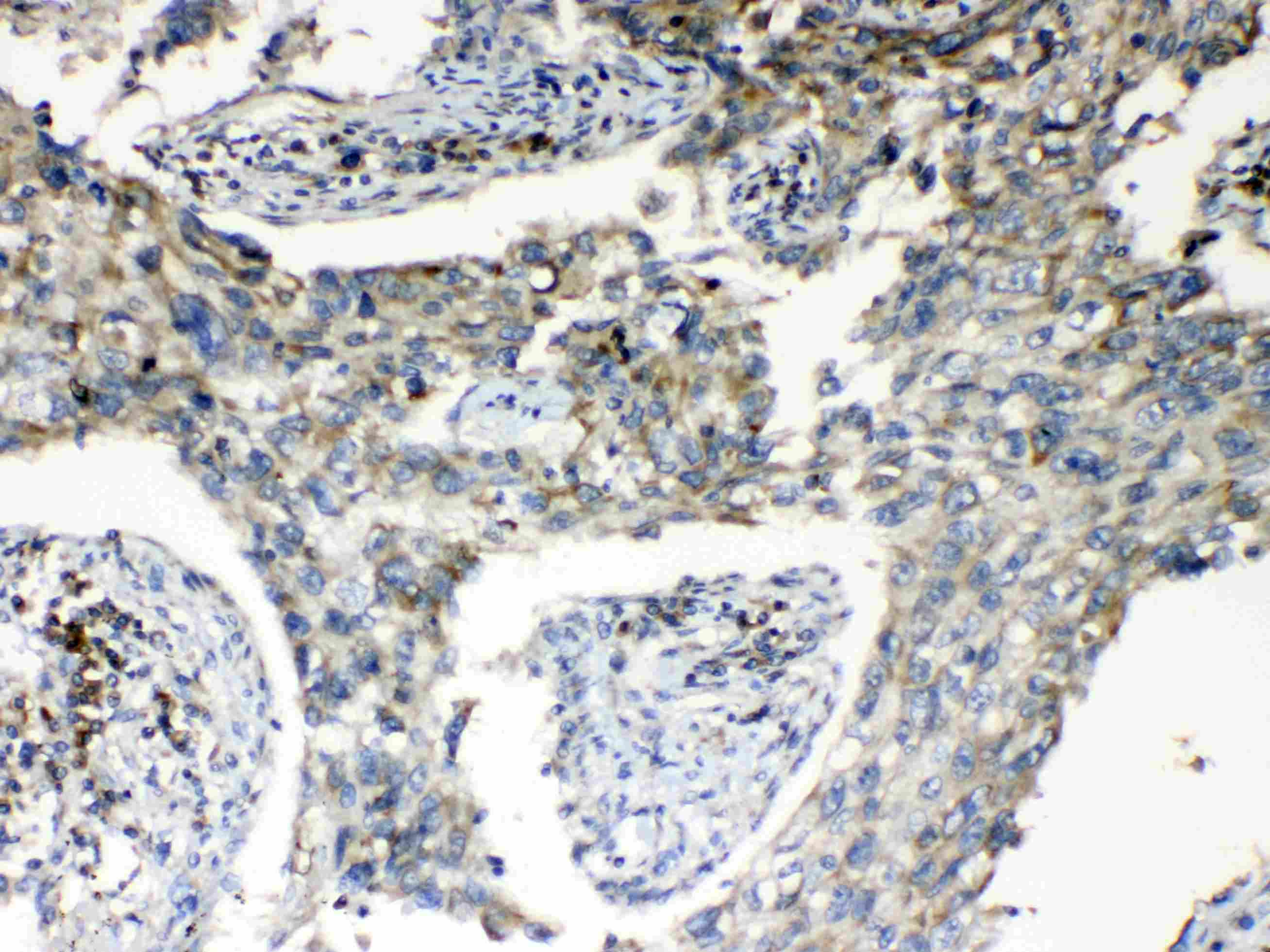 Polyclonal Rabbit anti-Human RPS6 / Ribosomal Protein S6 Antibody (IHC, WB)