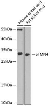 STMN4 / RB3 Antibody