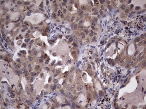Monoclonal Mouse anti-Human C14orf166 Antibody (clone OTI2C3, IHC, WB)