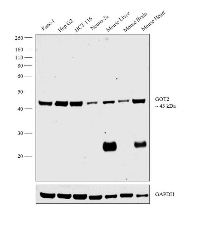 Monoclonal Mouse anti-Human GOT2 Antibody (clone 3000000000, IF, WB)