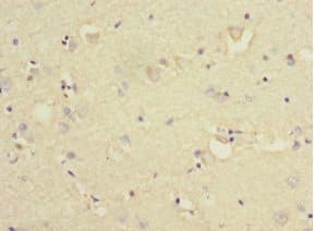 KLC1 / Kinesin Light Chain 1 Antibody