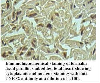 Polyclonal Rabbit anti-Human TANK2 / TNKS2 Antibody (IHC, WB)