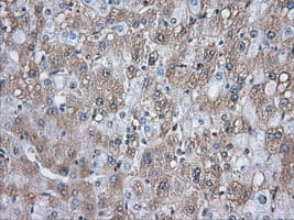 ERIC-1 / TACC3 Antibody (clone OTI6C6)