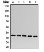 SCAD / ACADS Antibody