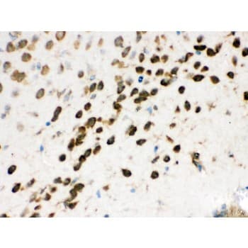 NONO / P54NRB Antibody (aa1-35)