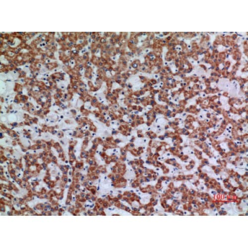 Polyclonal Rabbit anti-Human APAF1 / APAF-1 Antibody (501-550 aa, Internal, IHC, WB)