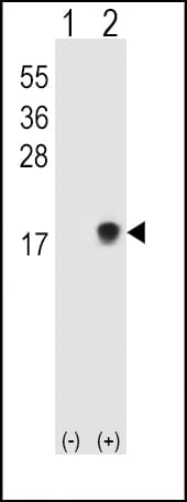 IHC-plus™ SUMO2 + SUMO3 Antibody (aa49-81)