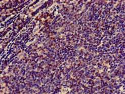 Polyclonal Rabbit anti-Human CD3E Antibody (IHC, IF)