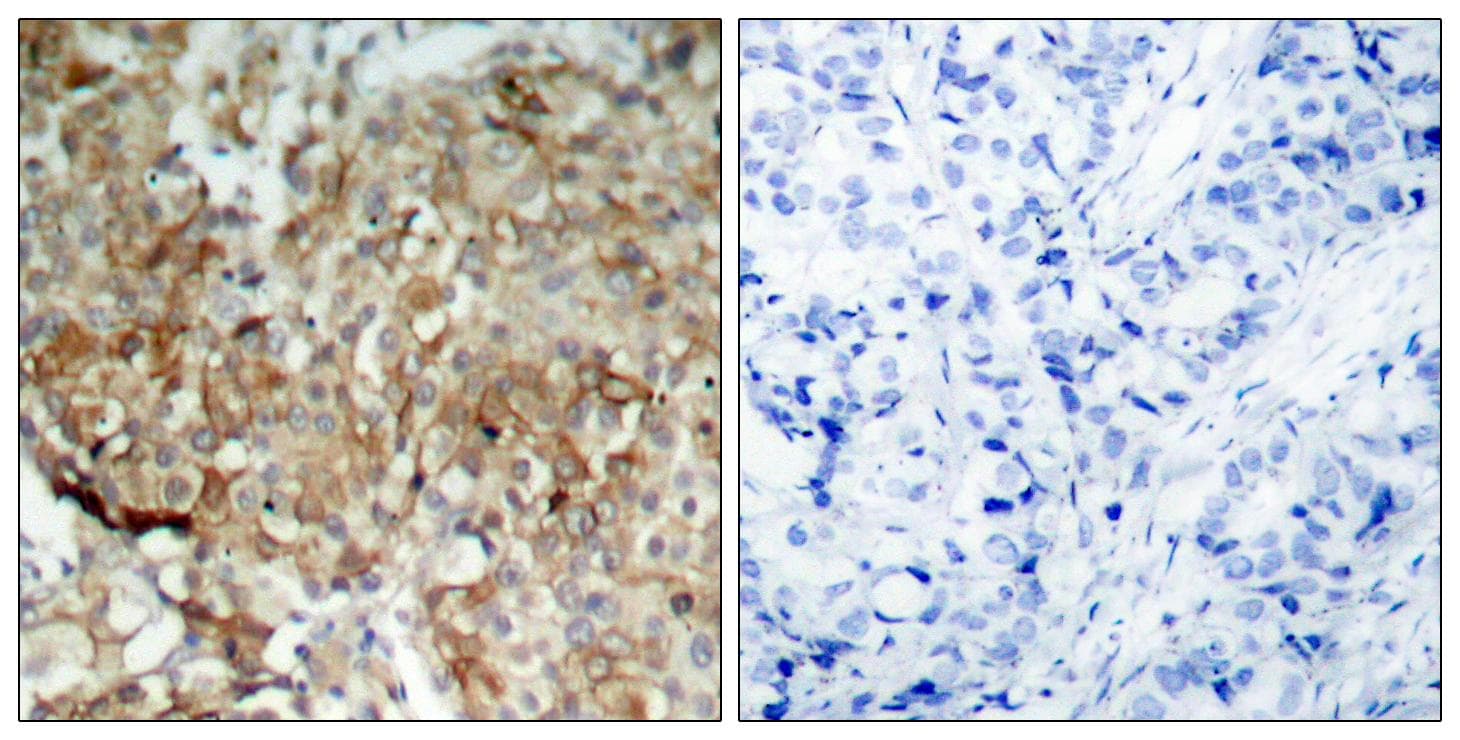 Polyclonal Rabbit anti-Human IGF1R / IGF1 Receptor Antibody (p1161, IHC, WB)