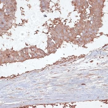 Polyclonal Rabbit anti-Human TGFBR2 Antibody (IHC, IF)