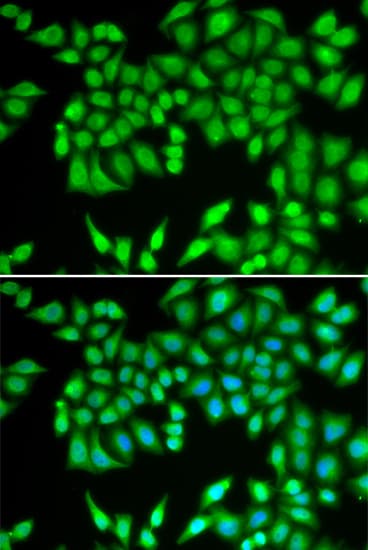 Polyclonal Rabbit anti-Human MCM3 Antibody (IHC, IF, WB)