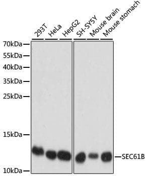 Polyclonal Rabbit anti-Human SEC61B Antibody (IF, WB)