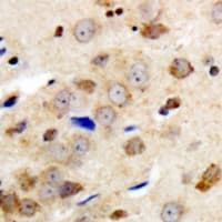 Polyclonal Rabbit anti-Human GABRG1 Antibody (N-Terminus, IHC, WB)