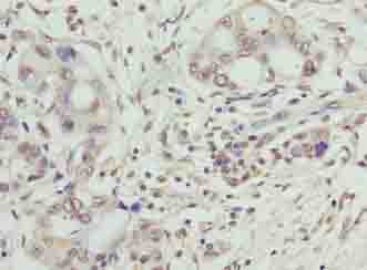 Polyclonal Rabbit anti-Human SYNJ2BP / OMP25 Antibody (IHC, WB)