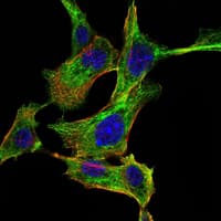 CHUK / IKKA / IKK Alpha Antibody (clone 3G12H9)
