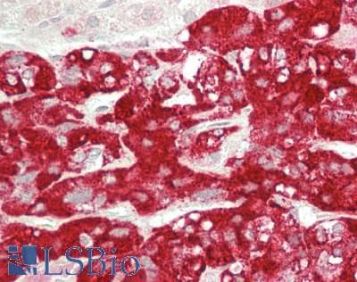 IHC-plus™ STMN4 / RB3 Antibody (C-Terminus)