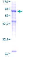 Human SLC39A7 / ZIP7 Protein (Recombinant GST)
