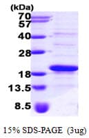 Human SRP14 Protein (Recombinant His)