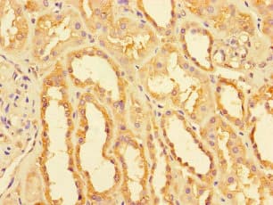 NDUFB11 Antibody