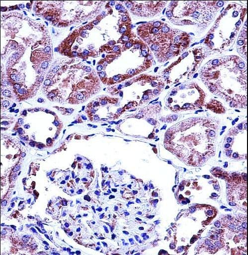 VR1 / TRPV1 Antibody (aa124-153)