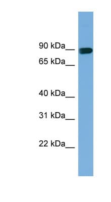 AFAP1 / AFAP Antibody (aa301-350)