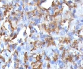CD68 Antibody (clone CDLA68-1)