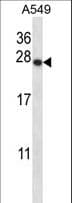 PSMD9 / 26S Proteasome Antibody (aa176-205)