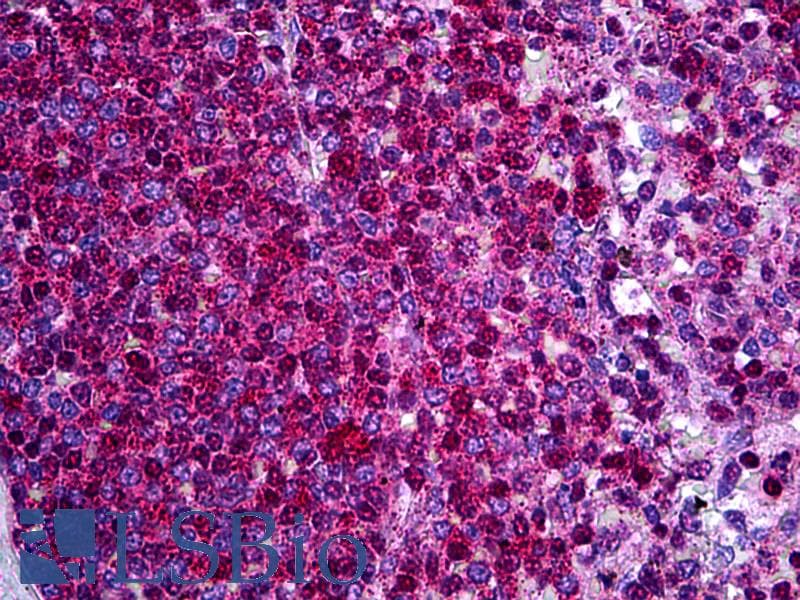 IHC-plus™ Polyclonal Rabbit anti-Human NCF1 / p47phox / p47 phox Antibody (aa341-390, IHC, WB)