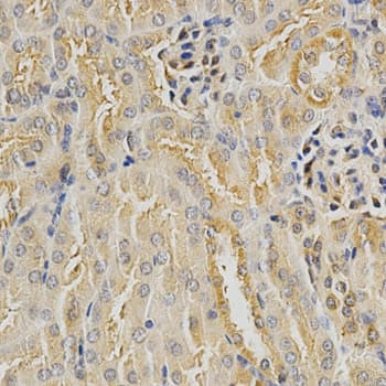 HDAC6 Antibody