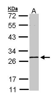 Polyclonal Rabbit anti-Human GK5 Antibody (aa9-297, IHC, WB)