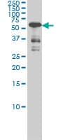 IHC-plus™ CAMK4 / CaMK IV Antibody (clone 1A3)