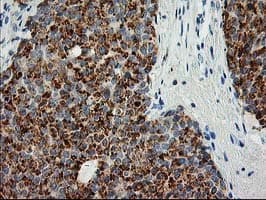 AK4 / Adenylate Kinase 4 Antibody (clone OTI5E7, Carrier-free)