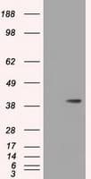 HIBCH Antibody (clone OTI3H5)