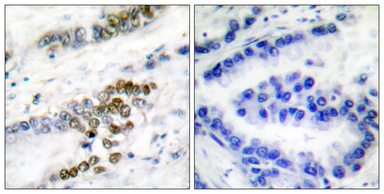 Polyclonal Rabbit anti-Human ERCC1 Antibody (IHC, WB)