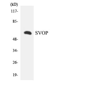 Polyclonal Rabbit anti-Human SVOP Antibody (aa260-309, WB)