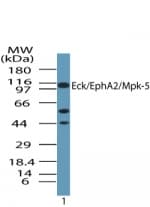 IHC-plus™ EPHA2 / EPH Receptor A2 Antibody (aa450-500)