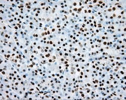 ARNT / HIF-1-Beta Antibody (clone OTI1A1)